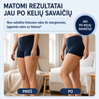 Veluna anticeliulitinis elektrinis masažuoklis