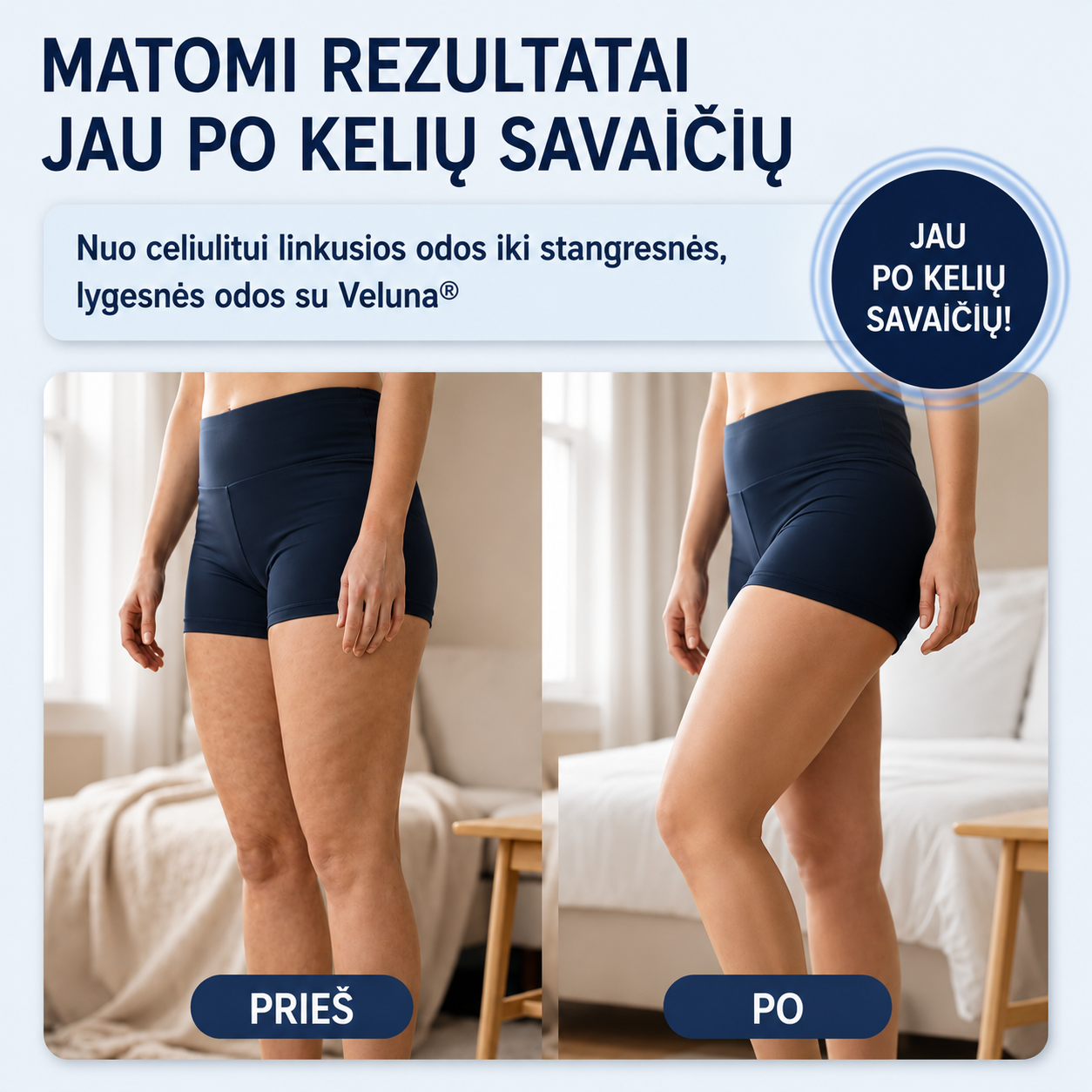 Veluna anticeliulitinis elektrinis masažuoklis
